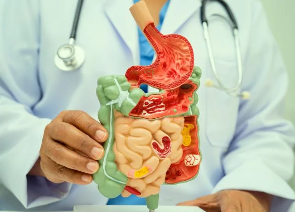colon irritable, pesadez y gastritis