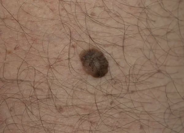 autocuidado para cuidar la piel mensualmente